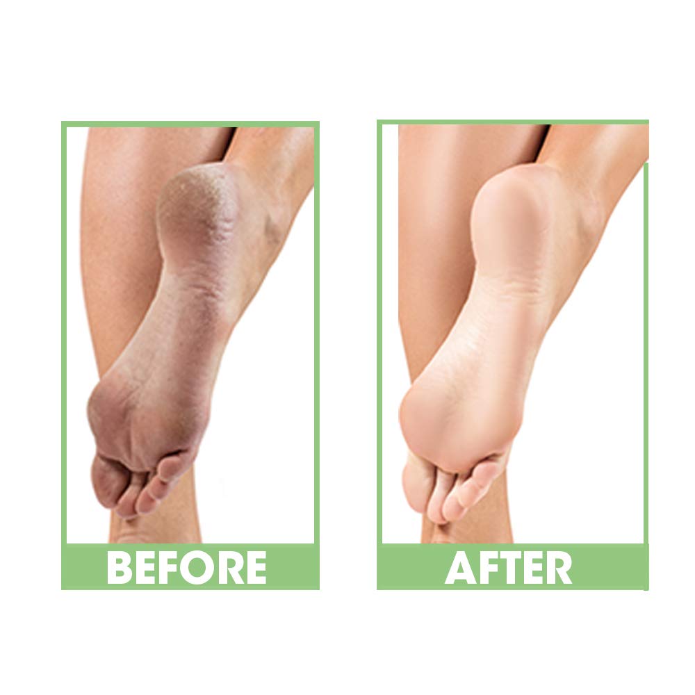 PROLINC | DRY HEEL ELIMINATOR 4 OZ